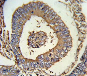 Calreticulin Antibody / CALR