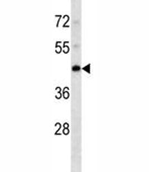 PDK4 Antibody