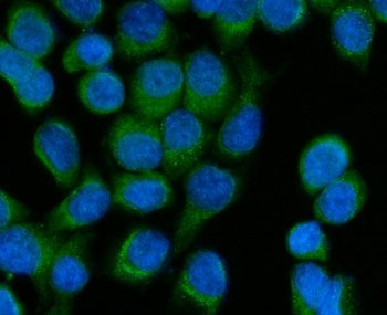 Immunofluorescent staining of FFPE human SiHa cells with SCCPDH antibody (green) and DAPI nuclear st