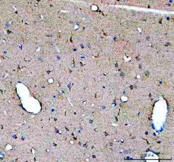 IHC staining of FFPE rat brain tissue with GDNF antibody. HIER: boil tissue sections in pH8 EDTA for