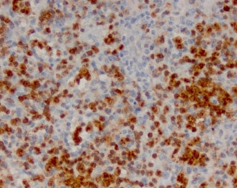 Annexin A1 Antibody