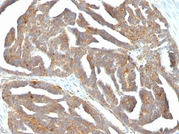 GnRH Receptor Antibody / GNRHR