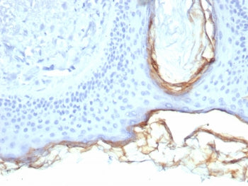 Kallikrein 5 Antibody / KLK5