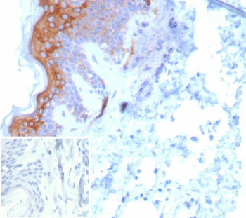IHC staining of FFPE human skin tissue with KRT6 antibody (clone KRT6/8267R). Inset: PBS used in pla