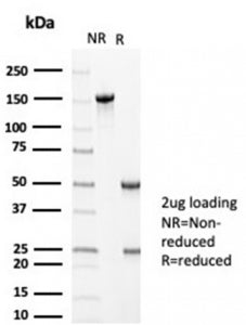 SDS-PAGE analysis of purified, BSA-free MLH1 antibody (clone MLH1/6710) as confirmation of integrity