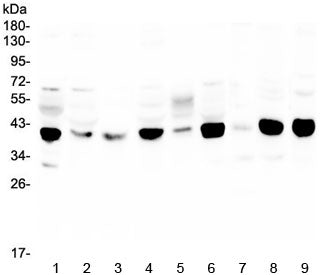 MCUR1 Antibody / Mitochondrial calcium uniporter regulator 1