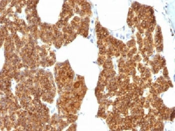 IHC testing of FFPE human parathyroid gland stained with PTH antibody. Required HIER: steam sections