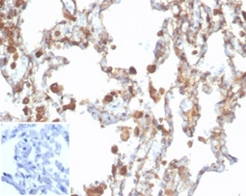 IHC staining of FFPE human lung tissue with recombinant ALDH1A1 antibody (clone rALDH1A1/7285). Nega