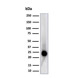 Western blot testing of human Jurkat cell lysate using recombinant CD3 epsilon antibody (clone C3e/4
