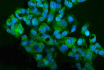 MT2-MMP Antibody / MMP15