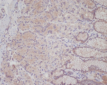 MET Antibody / c-Met / HGFR