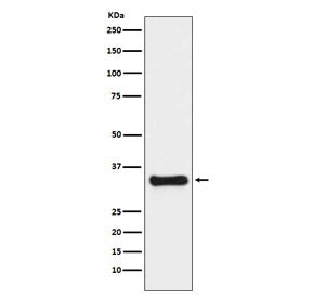 Thymidylate Synthase Antibody