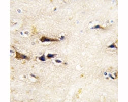 BACE1 Antibody