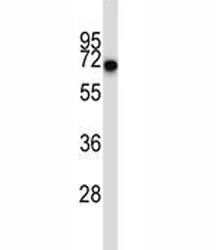 CD5 Antibody