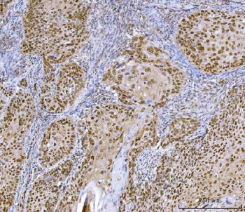 CUX1 Antibody / Homeobox protein cut-like 1
