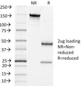 SDS-PAGE Analysis of Purified, BSA-Free hCG Receptor Antibody (clone LHCGR/1415). Confirmation of In