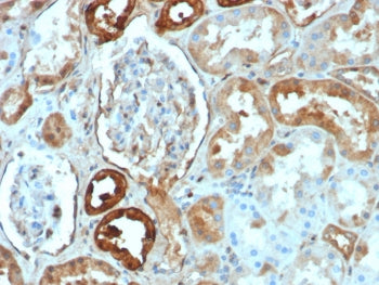 IHC staining of FFPE human kidney tissue with CALB1 antibody (clone rCALB1/8499). HIER: boil tissue 