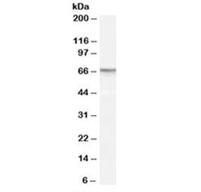 Western blot testing of human prostate lysate with PDE11A antibody at 1ug/ml. Predicted molecular we