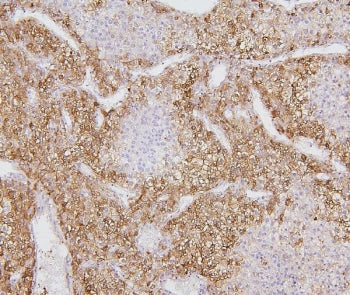 CYP2E1 Antibody / Cytochrome P450 2E1