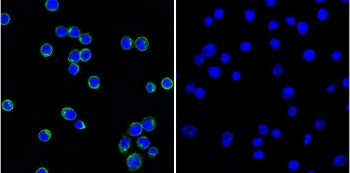 (Left) Immunofluorescent staining of permeabilized human Ramos cells with CF488-labeled Lambda Light