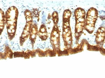 EpCAM Antibody