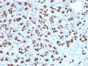 BARX1 Antibody