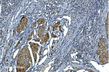 Alpha Actin Antibody / ACTA1 (skeletal muscle)