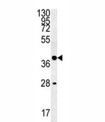 WNT8B Antibody