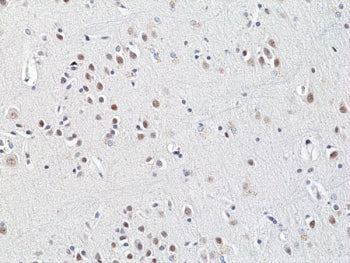 Recombinant HDAC3 Antibody