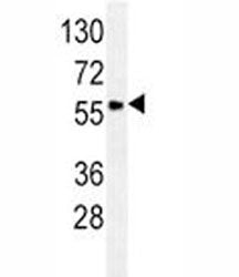 GCET1 / SERPINA9 Antibody