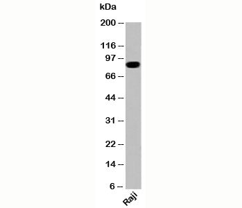 IKKb Antibody