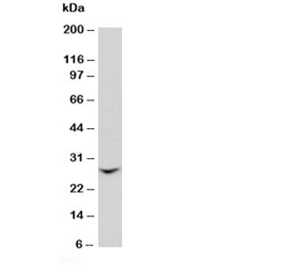 Western blot testing of GJB2 antibody and rat liver tissue lysate. Predicted molecular weight: ~26kD