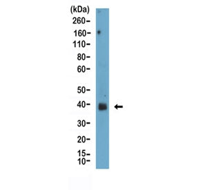 Podoplanin Antibody