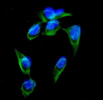GRK3 Antibody / ADRBK2
