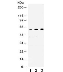 Western blot testing of 1) rat brain, 2) human placenta and 3) human PANC lysate with p54nrb antibod