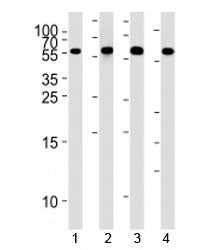 Western blot analysis of lysate from 1) HepG2, 2) NCI-H460,3) Raji, and 4) Ramos cell line using MMP