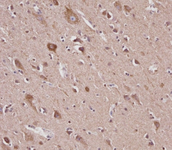 VDAC2 Antibody