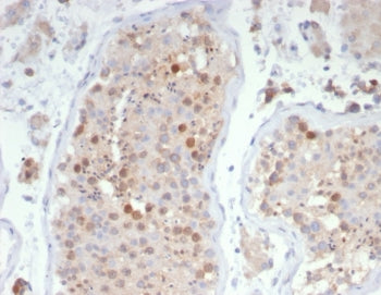 IHC staining of FFPE human testis tissue with KIF2C antibody (clone KIF2C/4706) at 2ug/ml. HIER: boi