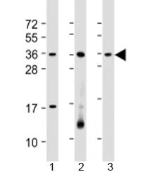 Western blot testing of human 1) HL-60, 2) Jurkat and 3) K562 cell lysate with RSPO1 antibody at 1:2