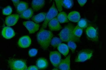 Sorcin Antibody / SRI