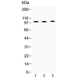 Western blot testing of 1) rat testis, 2) mouse testis and 3) MCF7 lysate with ADAM2 antibody at 0.5