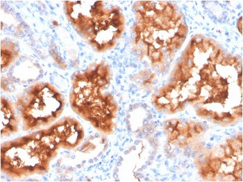IHC staining of FFPE human kidney with Carbonic Anhydrase IX antibody. HIER: boil tissue sections in