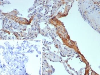 IHC staining of FFPE human lung tissue with Surfactant Protein D antibody (clone rSFTPD/8064). Inset