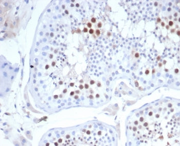 IHC staining of FFPE human testis tissue with KIF2C antibody (clone KIF2C/4702) at 2ug/ml. HIER: boi
