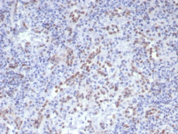 Cyclin D1 Antibody / CCND1