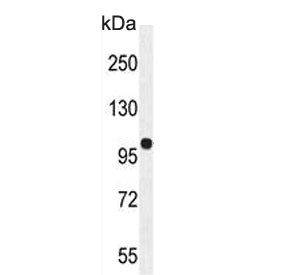 Estrogen-induced gene 121-like protein Antibody / EIG121L