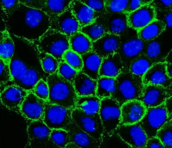 Immunofluorescent staining of FFPE human A431 cells with P Cadherin antibody (green) and DAPI nuclea