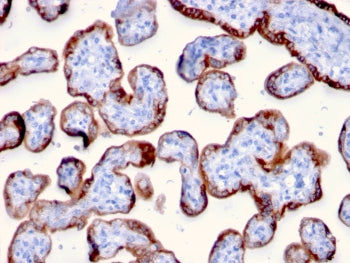 PAPP-A Antibody / Pappalysin-1