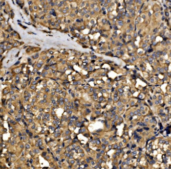 SRP72 Antibody / Signal recognition particle 72 kDa protein, 100ug