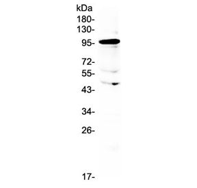 AMOTL2 Antibody